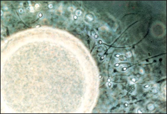 Sperm approaching the ovum