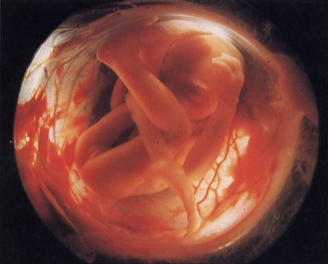 fetus at six months